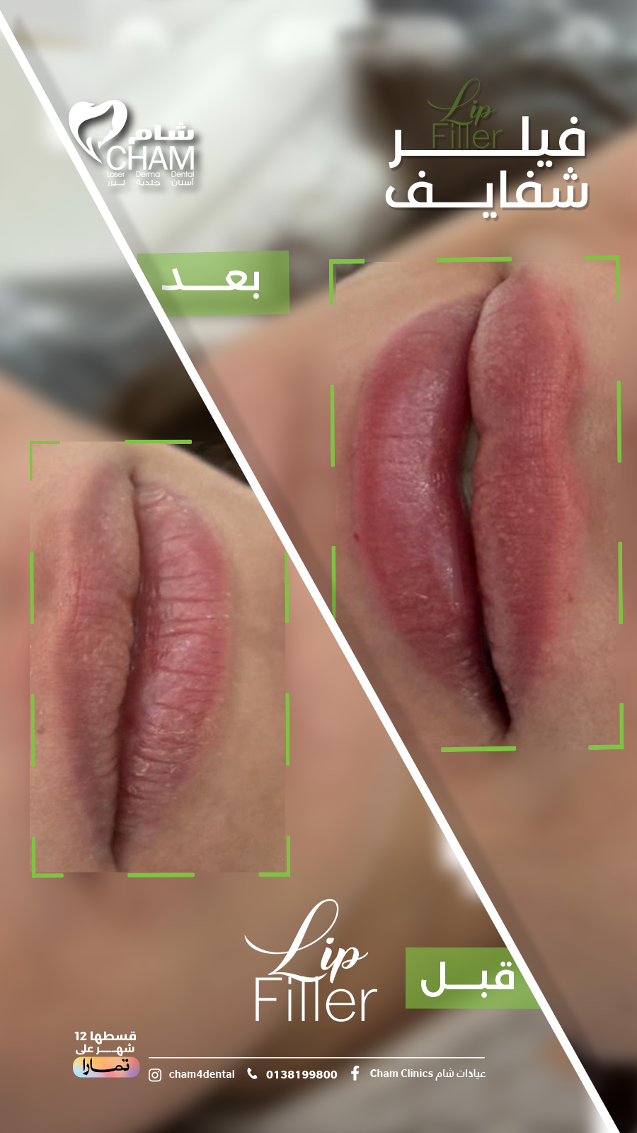 Untitled-1filler-900